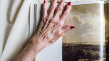 Крепирана кожа, как се появява и как да се предпазите – Светът на здравето